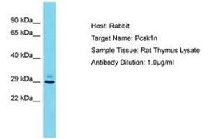 Image no. 1 for anti-Proprotein Convertase Subtilisin/kexin Type 1 Inhibitor (PCSK1N) (AA 54-103) antibody (ABIN6750411) (PCSK1N antibody  (AA 54-103))