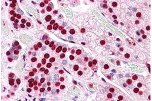 Human Adrenal: Formalin-Fixed, Paraffin-Embedded (FFPE) (COMT antibody  (Internal Region))