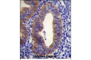 FGD6 Antibody (C-term) (ABIN655060 and ABIN2844689) immunohistochemistry analysis in formalin fixed and paraffin embedded human uterus tissue followed by peroxidase conjugation of the secondary antibody and DAB staining. (FGD6 antibody  (C-Term))
