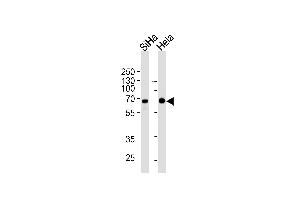 NLK Antibody (ABIN1882269 and ABIN2843492) western blot analysis in SiHa,Hela cell line lysates (35 μg/lane).
