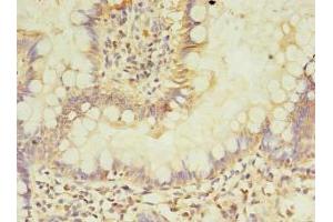 Immunohistochemistry of paraffin-embedded human small intestine tissue using ABIN7144191 at dilution of 1:100 (ASB6 antibody  (AA 1-197))