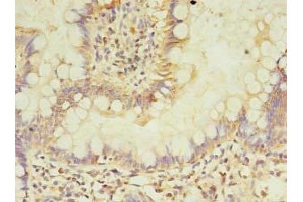 ASB6 antibody  (AA 1-197)