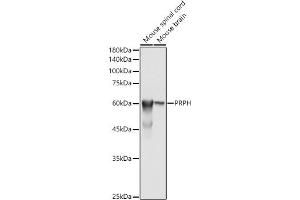 Western blot analysis of extracts of various cell lines, using PRPH antibody (ABIN1682318, ABIN3018463, ABIN3018464 and ABIN6220472) at 1:500 dilution. (Peripherin antibody  (AA 1-260))
