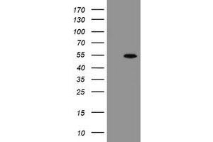 Western Blotting (WB) image for anti-rho GTPase Activating Protein 2 (ARHGAP2) antibody (ABIN1499632) (CHN1 antibody)