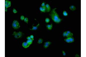 Immunofluorescence staining of MCF-7 cells with ABIN7144607 at 1:166, counter-stained with DAPI. (ARMC1 antibody  (AA 28-160))