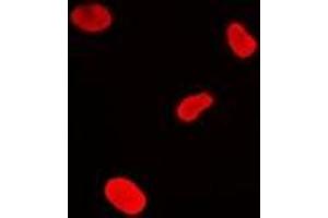 Immunofluorescent analysis of MacroH2A1 staining in U2OS cells. (H2AFY antibody)