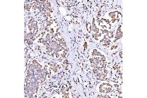 IHC analysis of SUCLG1 using anti-SUCLG1 antibody (ABIN7600906).
