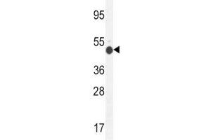 GCNT2 antibody western blot analysis in mouse kidney tissue lysate (GCNT2 antibody  (AA 364-391))