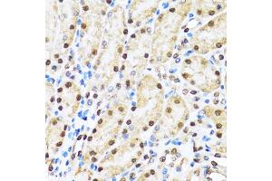 Immunohistochemistry of paraffin-embedded mouse kidney using CCAR2 antibody (ABIN5974285) at dilution of 1/100 (40x lens). (CCAR2 antibody)