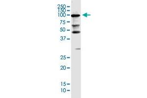 KIAA0226 monoclonal antibody (M03), clone 2G8. (Rubicon antibody  (AA 1-375))