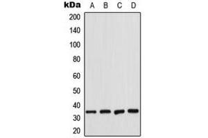 Western blot analysis of CDK2 expression in K562 (A), HeLa (B), NIH3T3 (C), rat heart (D) whole cell lysates.
