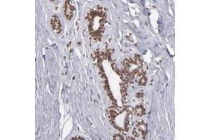 Immunohistochemical staining of human breast with KIAA0020 polyclonal antibody  shows nuclear membranous positivity in glandular cells at 1:50-1:200 dilution. (KIAA0020 antibody)