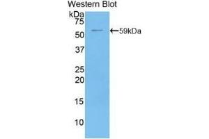 Detection of recombinant CD73 using Polyclonal Antibody to Cluster Of Differentiation 73 (CD73) (CD73 antibody  (AA 29-550))