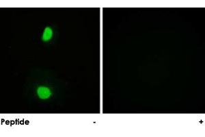 Immunofluorescence analysis of HeLa cells, using KAT5 polyclonal antibody . (KAT5 antibody)