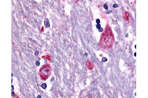 Anti-CHRM3 / M3 antibody IHC of human brain, caudate. (CHRM3 antibody  (Cytoplasmic Domain))