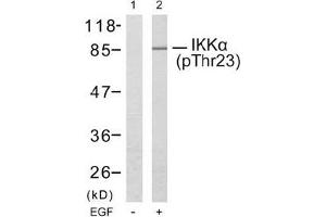 Image no. 2 for anti-conserved Helix-Loop-Helix Ubiquitous Kinase (CHUK) (pThr23) antibody (ABIN196836) (IKK alpha antibody  (pThr23))