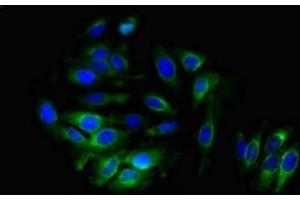 Immunofluorescent analysis of A549 cells using ABIN7143668 at dilution of 1:100 and Alexa Fluor 488-congugated AffiniPure Goat Anti-Rabbit IgG(H+L) (ALDH3B1 antibody  (AA 168-449))