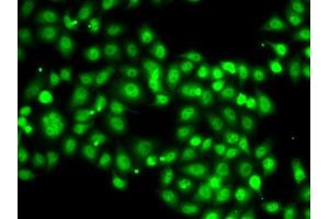Immunofluorescence analysis of A-549 cells using SETBP1 antibody (ABIN6132919, ABIN6147635, ABIN6147636 and ABIN6223042). (SETBP1 antibody  (AA 1-242))