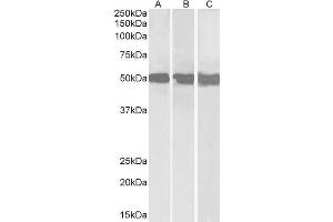 Western Blotting (WB) image for DEAD (Asp-Glu-Ala-Asp) Box Polypeptide 6 (DDX6) peptide (ABIN368790) (DEAD (Asp-Glu-Ala-Asp) Box Polypeptide 6 (DDX6) Peptide)