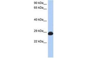 Image no. 1 for anti-RAB39B, Member RAS Oncogene Family (RAB39B) (N-Term) antibody (ABIN6743734) (RAB39B antibody  (N-Term))