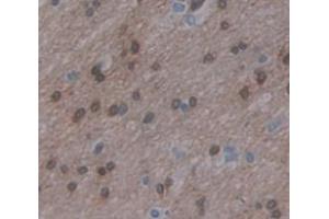 Figure. (ZFHX4 antibody  (AA 1-189))
