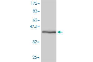 Western Blot detection against Immunogen (42. (GMFB antibody  (AA 1-154))