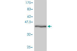 Western Blot detection against Immunogen (42. (GMFB antibody  (AA 1-154))