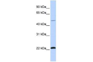 WB Suggested Anti-WWP2 Antibody Titration:  0. (WWP2 antibody  (C-Term))