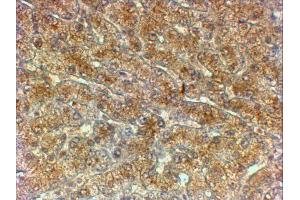 ABIN2613388 (2µg/ml) staining of paraffin embedded Human Liver. (ATG4A antibody  (Internal Region))