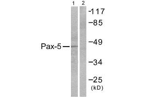 Western Blotting (WB) image for anti-Paired Box 5 (PAX5) (N-Term) antibody (ABIN1848732) (PAX5 antibody  (N-Term))