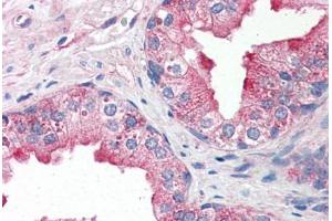 Human Prostate (formalin-fixed, paraffin-embedded) stained with TNFRSF25 antibody ABIN343911 at 10 ug/ml followed by biotinylated goat anti-rabbit IgG secondary antibody ABIN481713, alkaline phosphatase-streptavidin and chromogen. (DR3/LARD antibody  (AA 25-40))