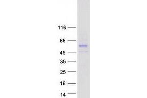 Western Blotting (WB) image for Regulator of G-Protein Signaling 11 (RGS11) (Transcript Variant 1) protein (Myc-DYKDDDDK Tag) (ABIN2730810)