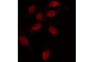 ABIN6275939 staining MCF7 by IF/ICC. (OPN3 antibody  (Internal Region))
