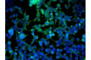 Image provided by One World Lab validation program. (Cadherin 5 antibody  (AA 601-700))