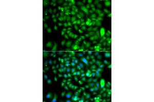 Immunofluorescence analysis of A549 cells using CSRP2BP antibody. (CSRP2BP antibody)