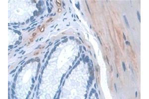 Immunohistochemistry (IHC) image for anti-WW and C2 Domain Containing 1 (WWC1) (AA 847-1094) antibody (ABIN7441667)