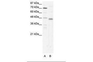 Image no. 1 for anti-Zfp-1 (AA 97-146) antibody (ABIN202318) (Zfp-1 antibody  (AA 97-146))