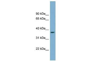 OR2W5 antibody used at 1 ug/ml to detect target protein. (OR2W5 antibody  (Middle Region))