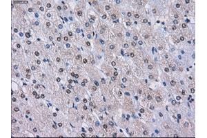 Immunohistochemical staining of paraffin-embedded endometrium tissue using anti-LOXmouse monoclonal antibody. (LOX antibody  (AA 22-168))