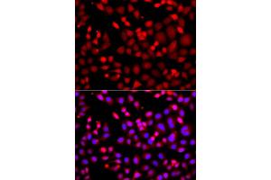 Immunofluorescence analysis of A549 cell using MTUS1 antibody. (MTUS1 antibody)