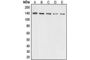 Western blot analysis of Collagen 3 alpha 1 expression in A10 (A), HeLa (B), mouse lung (C), mouse liver (D), rat lung (E) whole cell lysates. (COL3A1 antibody  (N-Term))