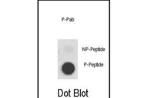 Dot blot analysis of anti-Phospho-MET-p Phospho-specific Pab (ABIN389596 and ABIN2839609) on nitrocellulose membrane. (c-MET antibody  (pTyr1356))
