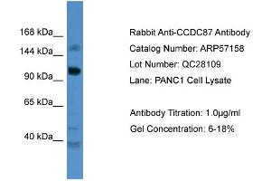 WB Suggested Anti-CCDC87  Antibody Titration: 0. (CCDC87 antibody  (C-Term))
