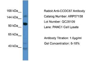 WB Suggested Anti-CCDC87  Antibody Titration: 0.