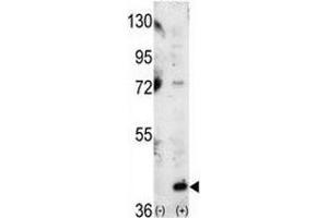 Western blot analysis of p38 antibody and 293 cell lysate (2 ug/lane) either nontransfected (Lane 1) or transiently transfected with the MAPK14 gene (2).