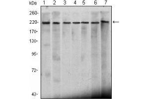 Western Blotting (WB) image for anti-Chromodomain Helicase DNA Binding Protein 3 (CHD3) antibody (ABIN2983311) (CHD3 antibody)