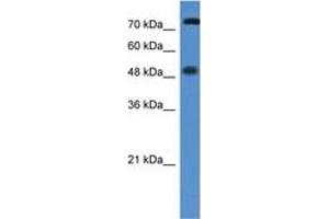 Image no. 1 for anti-Vitamin D Receptor (VDR) (AA 108-157) antibody (ABIN6746029) (Vitamin D Receptor antibody  (AA 108-157))