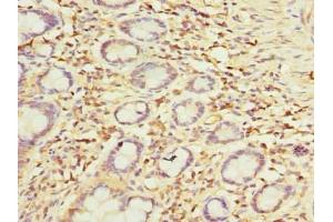 Immunohistochemistry of paraffin-embedded human small intestine tissue using ABIN7149808 at dilution of 1:100 (OTUD6B antibody  (AA 1-293))