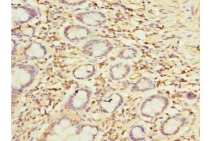 Immunohistochemistry of paraffin-embedded human small intestine tissue using ABIN7149808 at dilution of 1:100
