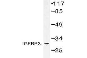 Western blot (WB) analysis of IGFBP3 antibody in extracts from HUVEC cells.